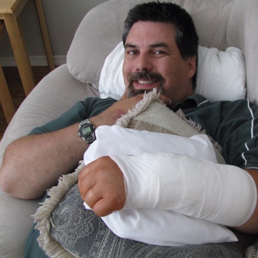 Darren Stolz lays on a couch with his arm in a cast.